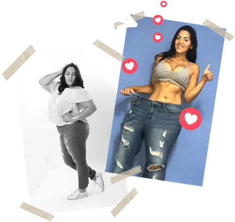 Paciente de manga gástrica antes y después